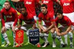 United Fitness Concerns for UCL Clash