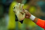 Uruguayan Keeper Loses 4 Fingers in DIY Accident