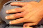 Check Out Hendricks' Swollen Hands After Pummeling GSP