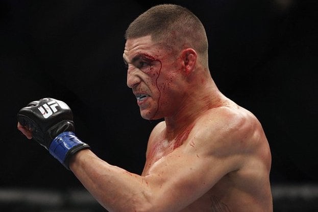 Conor McGregor: Diego Sanchez Is a Brain Dead, Stuttering Fool