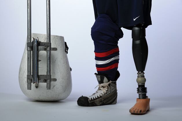 Sochi to Set New Bar for Winter Paralympic Games, Says Ottobock