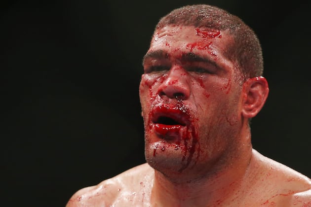 UFC Fight Night 33 Results: Antonio Silva Says Failed Test 'Was Not My Mistake'