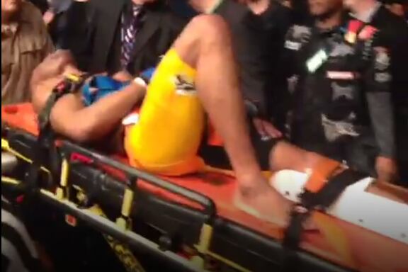 Anderson Silva Stretchered out of Octagon After Horrific Leg Break