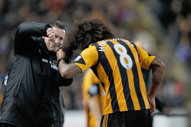 Hull City Star Tom Huddlestone's Hair Up to £1,000 on Ebay in Charity Auction
