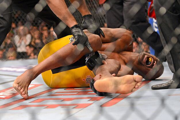 Anderson Silva Leg Break Update from Doctor Who Performed Surgery