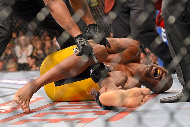 Anderson Silva Posts Latest 'Leg Break' Rehab Photo to His Instagram Page