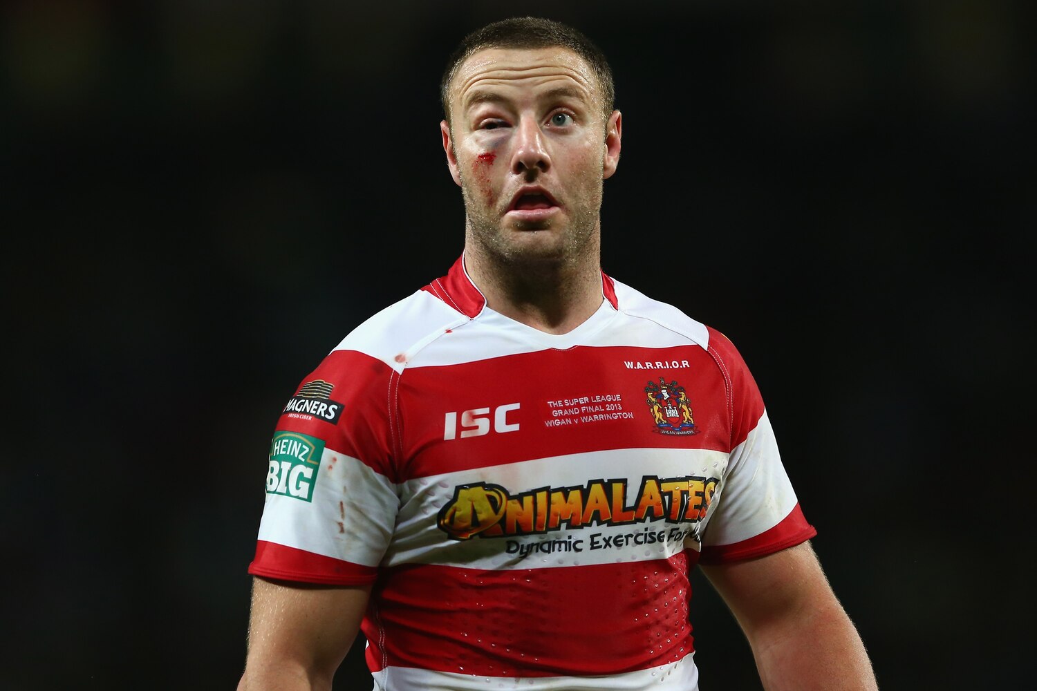 That Had to Hurt Athletes with Black Eyes and Broken Noses Bleacher