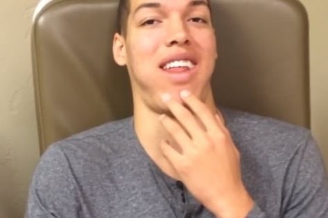 Instagram: Gordon After Wisdom Teeth Removed