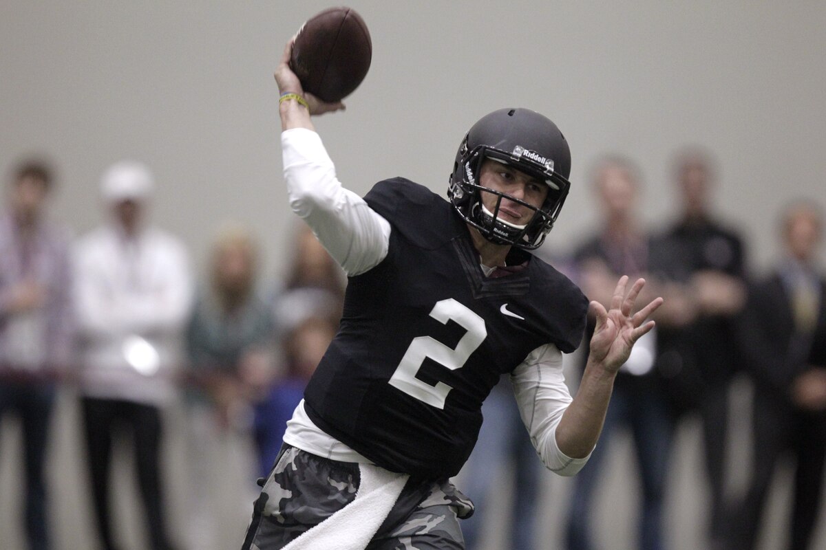 What are concussions picture