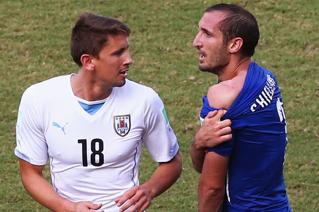 Uruguayan FA Defends Luis Suárez, Claiming Bite Marks Are Photoshopped