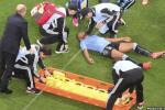Footballers 'Need Concussion Care'