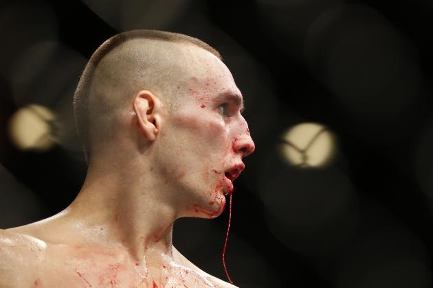 Rory MacDonald Injury: Updates on UFC Star's Nose, Foot