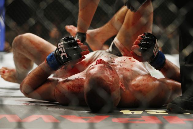 UFC 189: This Disturbing Post-Fight Scene Reminds Us What FIghters Endure 