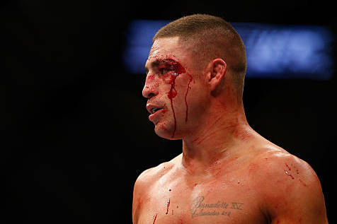 Diego Sanchez embodies the UFC's warrior ethos, but he has struggled in recent years.
