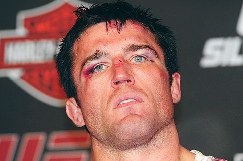 UFC on FOX 2 Results: 3 Questions We Still Have About Chael Sonnen