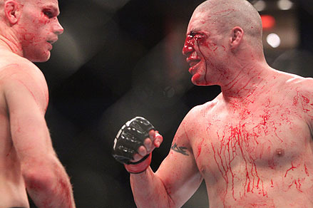 UFC on FUEL TV 1: Diego Sanchez vs. Martin Kampmann II Breakdown