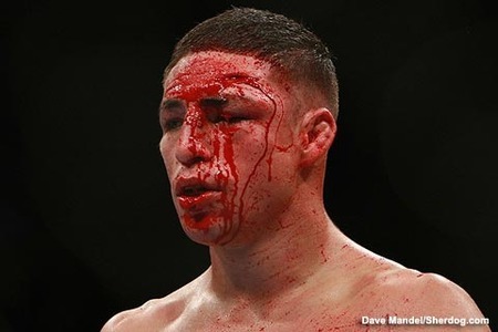 UFC on Fuel TV 1: Final Main Card Prediction