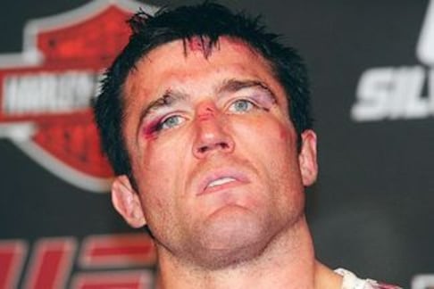 Chael Sonnen and the 10 Biggest Choke Artists in the UFC