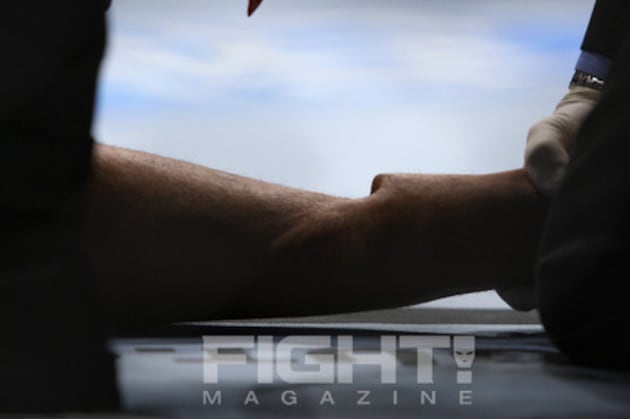 15 of the Worst Broken Bones in MMA History