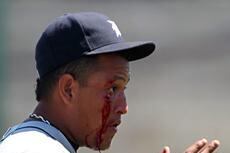Miguel Cabrera's Face and the 5 Most Bloodied Injuries in Baseball History