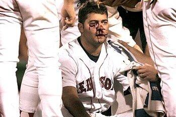 40 Most Horrifying Comebackers in Baseball History