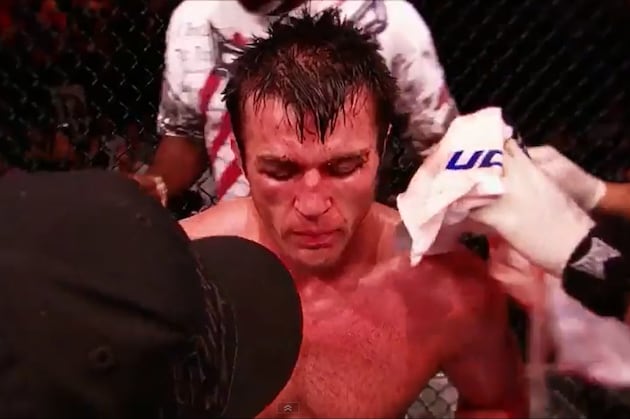 Chael Sonnen and the Biggest Title Fight Gaffes in UFC History