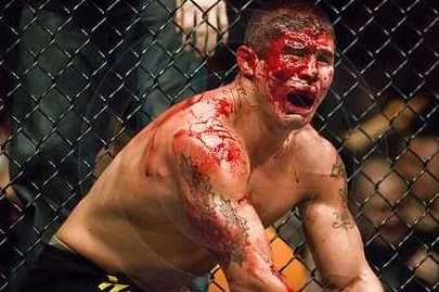 MMA Fighter Appreciation 101: Blood, Bruises and Broken Bones