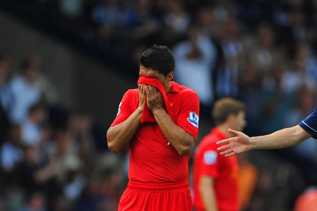 Liverpool FC: 6 Things Brendan Rodgers Must Get Right Before City Arrive