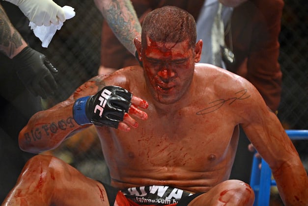 Top 10 'Oh S#*@!' Moments in MMA History