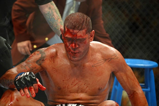 UFC on FX 5: Travis Browne vs. Antonio Silva Head-to-Toe Breakdown