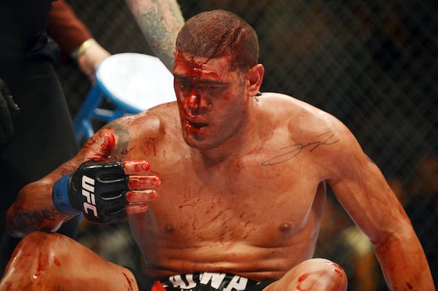 The Most Overrated Fighters in Each UFC Division