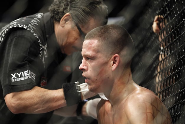 Benson Henderson vs. Nate Diaz: 5 Fights for Nate Diaz to Take Next