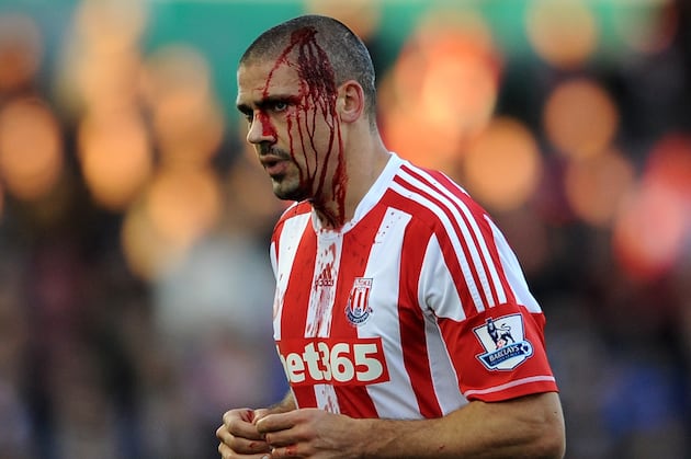 What Is Wrong with World Football: Its 10 Biggest Headaches