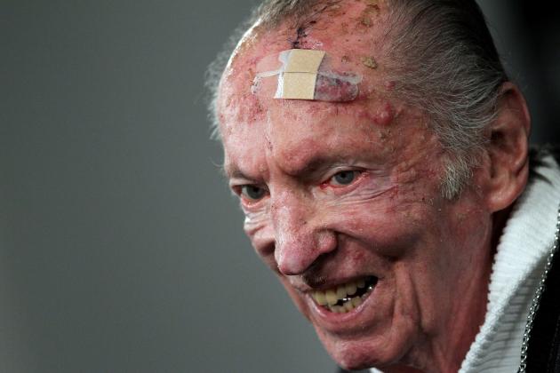 Sports Pictures That Will Give You Nightmares