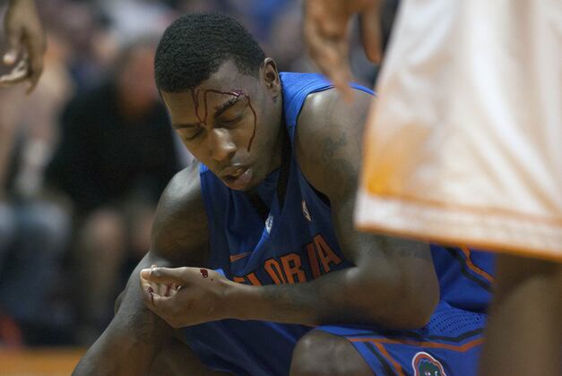 Florida Basketball: What Gators Can Learn from Each of Their Losses