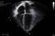 Echocardiograms allow doctors and technicians to view the four chambers of the heart as well as the valves and vessels connecting them.