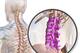 The lumbar spine encases and protects the spinal cord in the lower back.