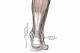 The Achilles tendon—seen here as a thick white band—connects the calf muscles to the back of the heel, allowing an athlete to plantarflex (point his or her toes).