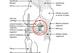 The ACL is one of the four main knee ligaments. It connects the tibia to the femur and prevents the knee from twisting inward and the tibia from moving forward.