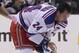Ryan Callahan after suffering a hit to the face versus the Los Angeles Kings in 2013.