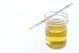 Specific gravity strip test