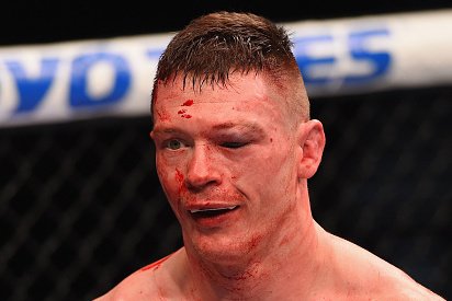 UFC 195 Results: Dustin Poirier Bests Joe Duffy in Bloody Lightweight Clash | Bleacher Report | Latest News, Videos and