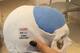 Kuric now wears this synthetic material at the front of his skull.