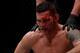 Weidman, after getting KOed by Romero at UFC 205.