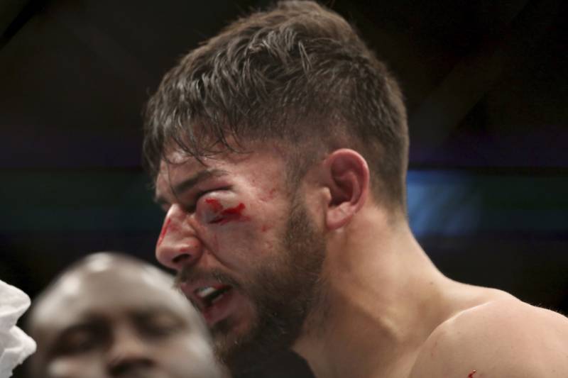 Rodriguez's eye, and his career, took a fair bit of damage at UFC 211.