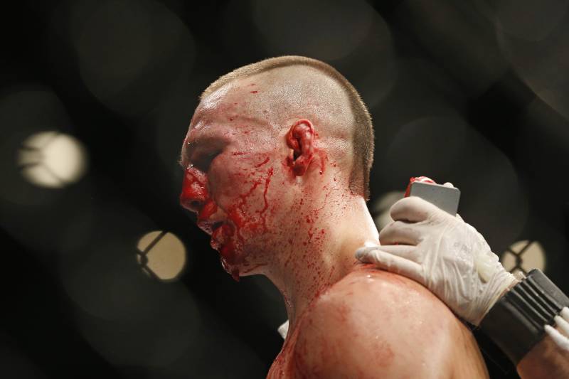 MacDonald after his UFC 189 loss to Robbie Lawler.