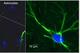 Astrocyte cells, depicted here, are the focus of Dr. William Korinek's research into combatting the effects of brain trauma.