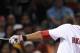 Carl Crawford's wrist surgery may cause him to miss opening day.