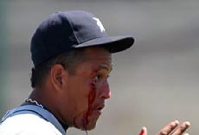 Miguel Cabrera's Face and the 5 Most Bloodied Injuries in Baseball History, News, Scores, Highlights, Stats, and Rumors