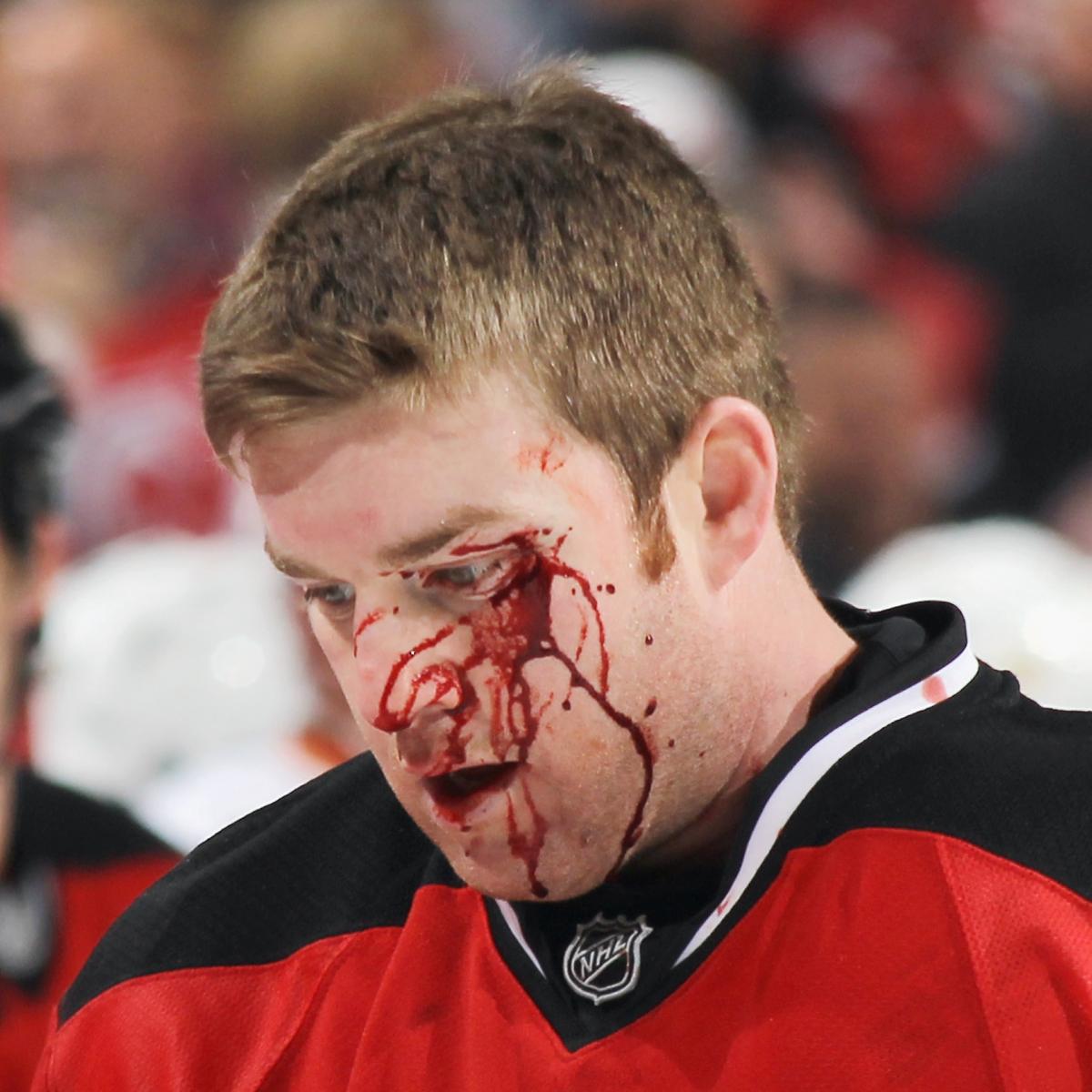 NHL star suffers gruesome skate to face during game and forced to have 75  stitches after horror injury